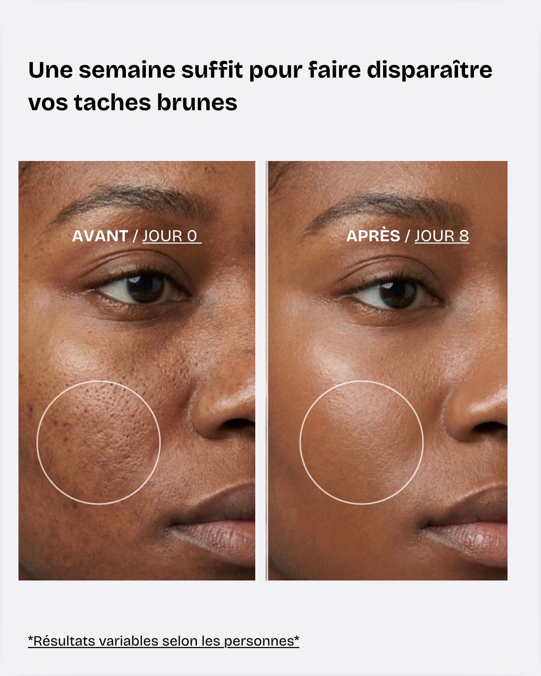Routine anti-taches brunes