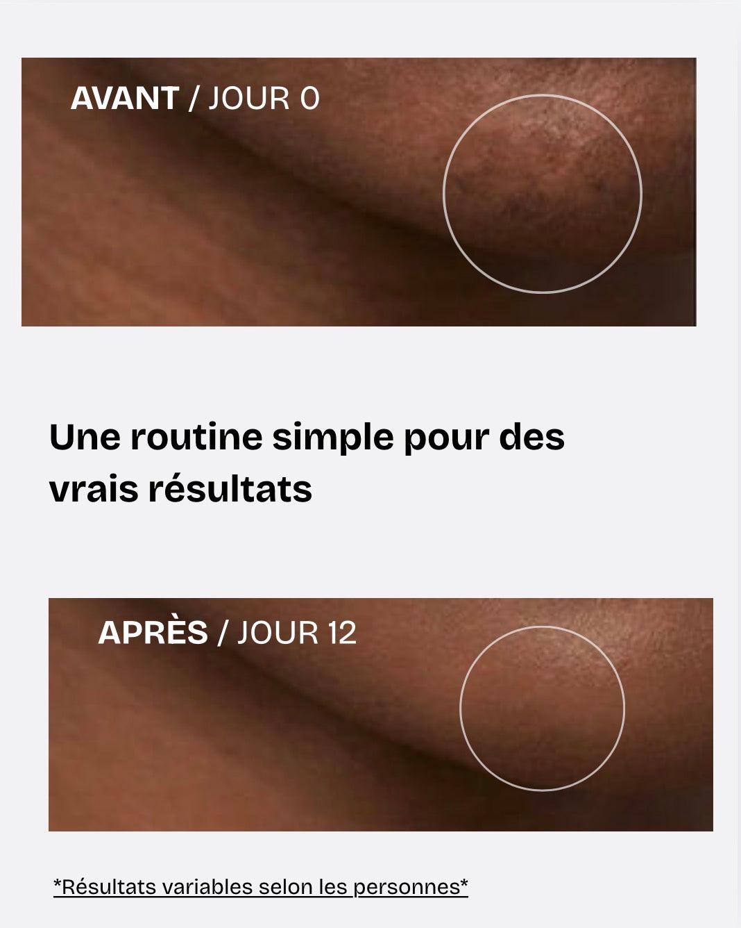 Routine anti-taches brunes